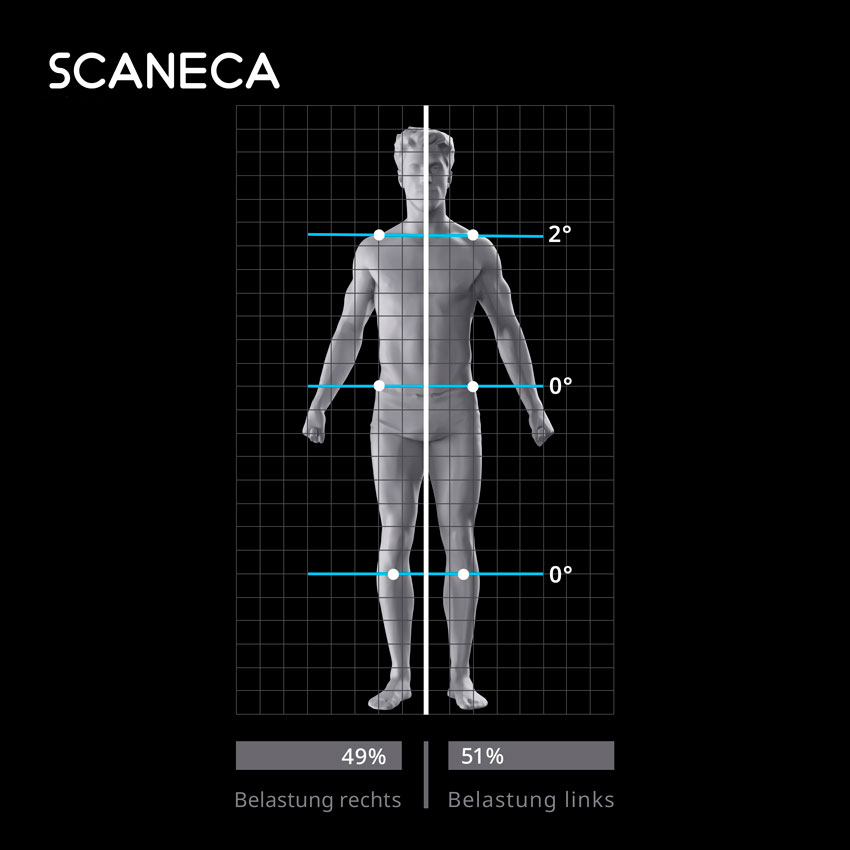 Musterbild SCANECA Auswertung der Seitenbelastung Frontansicht